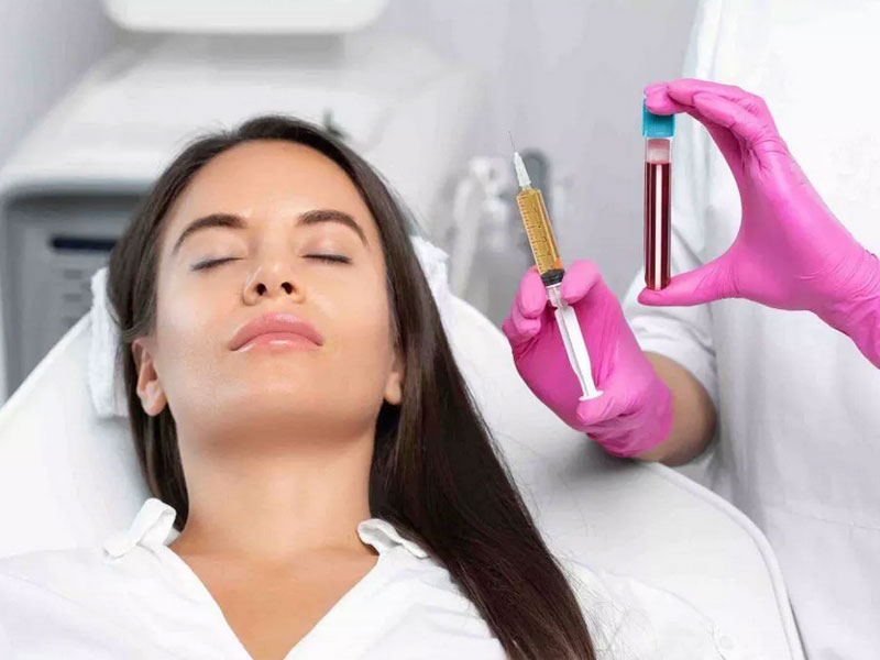 پی آر پی (PRP) چیست؟